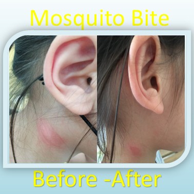 Natural Orange jasmine essential Hydrosol with Lemon Myrtle essential Oil