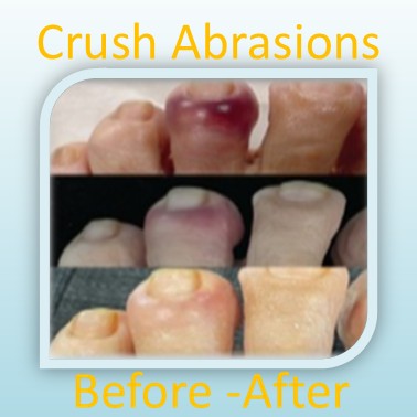 Natural Orange jasmine essential Hydrosol with Lemon Myrtle essential Oil