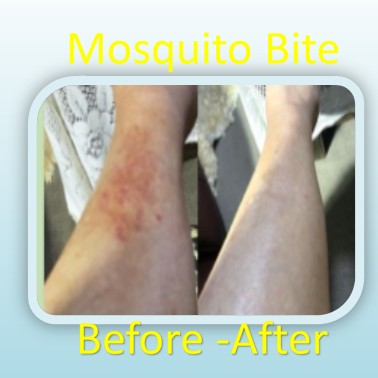 Natural Orange jasmine essential Hydrosol with Lemon Myrtle essential Oil