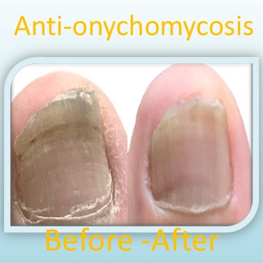 Natural Orange jasmine essential Hydrosol with Lemon Myrtle essential Oil